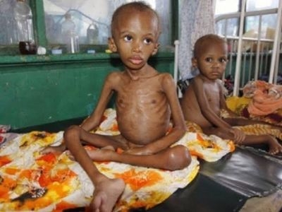 MSF OVERWHELMED AS ADMISSION OF SEVERELY MALNOURISHED CHILDREN SPIKES 100% IN NORTHERN NIGERIA