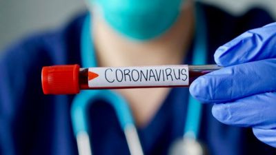 NIGERIA HITS 373 CORONAVIRUS CASES, NCDC CONFIRMS 30 MORE